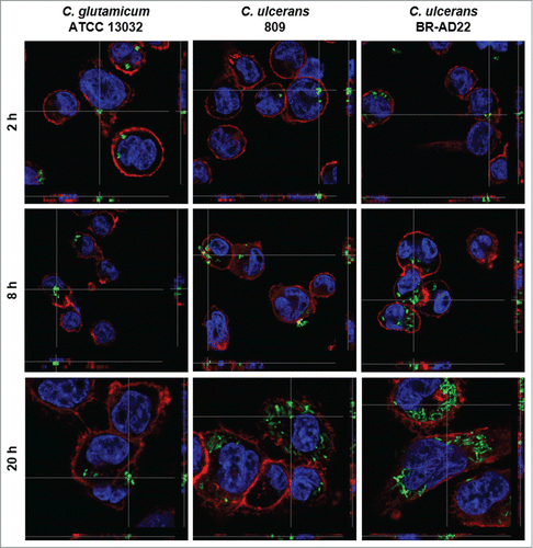 Figure 1. Fluorescence microscopy of C. ulcerans and THP-1 cells. THP-1 cells were infected with C. glutamicum ATCC 13032 pEPR1p45gfp, C. ulcerans 809 pEPR1p45gfp and C. ulcerans BR-AD22 pEPR1p45gfp at an MOI of 10 for 30 min. Extracellular bacteria were killed by the addition of gentamicin and after different time points, cells were fixed. Nuclei were stained with DAPI, the cytoskeleton with Alexa Fluor® 647 Phalloidin and z-stack micrographs were taken using the confocal laser-scanning microscope Leica SP5 II and analyzed with the LAS software suite to proof that bacteria are located inside of the macrophages. Representative pictures are shown.