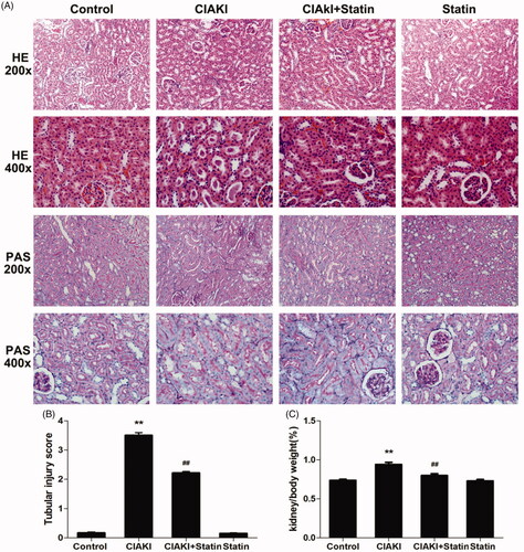 Figure 3. Atorvastatin protects renal morphology in rat CIAKI model. Representative photomicrographs of HE and PAS stained kidney sections (A), and semi-quantitative scoring analysis of tubular degeneration were presented (B). Marked tubular vacuolization and degeneration, necrosis, and hyaline or cellular casts associated with infiltration of mononuclear cells were shown. For the semi-quantitative analysis of morphological changes, 10 high magnification (×200) fields of the cortex and the outer stripe of the outer medulla in rats were randomly selected. The extent of tubular injury was then graded with a score from 0 to 4 points. Iopromide caused severe tubular injuries at 48 h after iopromide injection. However, pretreatment with atorvastatin remarkably attenuated the tubular injuries. The Kw/Bw was elevated at 48 h after iopromide injection (C), which could also be mitigated by atorvastatin. Data are presented as mean ± SD (n = 6). **p < 0.01 versus control group. ## p < 0.01 versus CIAKI group.