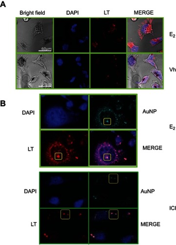 Figure 5 Image shown the effect of E2 on cellular AuNP uptake and vesicle formation; representative observations were acquired in CLSM. (A) From left to right it can be seen MCF-7 cells in the bright field, DAPI-stained nuclei (blue), endosomal-lysosomal system stained with LT (red) and highlighted areas of colocalization (squares), where it is shown that E2 increases lysosomes formation compared with Vh-treated cells. (B) E2 increases AuNP uptake (cyan) by the lysosomes pathway (red), effect that is precluded in the presence of the ER antagonist (ICI). Scale bars are 60 μm.Abbreviations: AuNP, gold nanoparticle; CLSM, confocal laser scanning microscopy; DAPI, 4',6-diamidino-2-phenylindole; E2, 17β-estradiol; ICI, 7α,17β-[9-[(4,4,5,5,5-Pentafluoropentyl)sulfinyl]nonyl]estra-1,3,5(10)-triene-3,17-diol; LT, LysoTracker; Vh, vehicle.