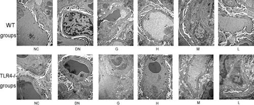 Figure 7 Effect of DMDD on the ultrastructural changes in the renal tissue of WT and KO mice. NC: normal control, DN: diabetic nephropathy group, G: gliquidone group (10 mg.kg−1.d−1), H: high dosage of DMDD group (50 mg.kg−1.d−1), M: medium dosage of DMDD group (25 mg.kg−1.d−1), L: low dosage of DMDD group (12.5 mg.kg−1.d−1).Abbreviations: DMDD, 2- dodecyl-6-methoxycyclohexa-2,5-diene-1,4-dione; WT, wild type; KO, knockout.