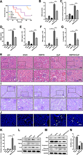 Figure 6 Exogenous HSP70 ameliorates renal damage via inhibition of inflammation-mediated apoptosis in sepsis‐induced AKI in vivo.