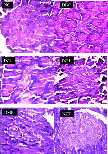 Figure 5. Representative sections of histopathological examinations of the pancreas from different animal groups. The NC group had higher number of cells per islet while the DBC and DZL group had smaller pancreatic islets with very few cells. The DZH had relatively higher number of cells per islet compared to DBC and DZL groups but far lower than the NC group. NC: Normal Control; DBC: Diabetic Control; DZL: Diabetic Ziziphus mucronata low dose (150 mg/kg bw); DZH: Diabetic Ziziphus mucronata high dose (300 mg/kg bw); DMF: Diabetic metformin; NZT: Normal Ziziphus mucronata toxicological dose (300 mg/kg bw).