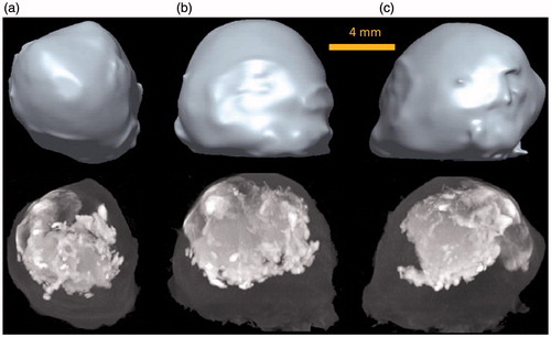 Figure 5. Pro/Engineer models and corresponding maximum intensity projection (MIP) images of a scanned tumour in the (a) axial plane, (b) sagittal plane, and (c) coronal plane.