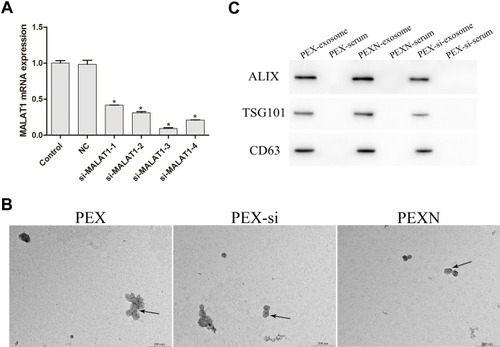 Figure 3 Controls for interference expression. (A) MALAT1 expression in Control, NC, and si-MALAT1 (1–4) groups. (B and C) Identification of exosomes in PEX, PEX-si, and PEXN groups by Western blot and TEM (scale bar = 500 nm). Arrows indicate exosomes. *P < 0.05 vs Control.