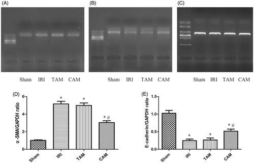 Figure 5. The mRNA level of α-SMA and E-cadherin in the kidney. (A) Effects of metformin on the mRNA level of α-SMA after 45 min of ischemia followed by 12 weeks of reperfusion. (B) Effects of metformin on the mRNA level of E-cadherin after 45 min of ischemia followed by 12 weeks of reperfusion. (C) The mRNA level of GAPDH after 45 min of ischemia followed by 12 weeks of reperfusion. (D) Relative band densities of α-SMA to the mean value of the control. (E) Relative band densities of E-cadherin to the mean value of the control (*p < 0.05 versus the sham group, #p < 0.05 versus the IRI group. n = 5).