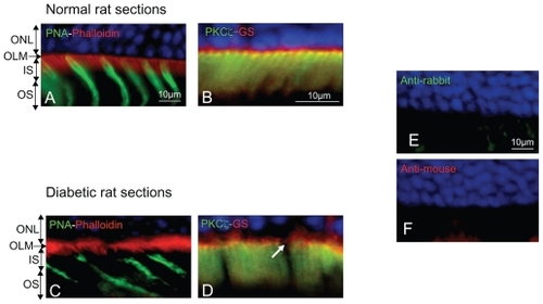 Figure 2 Immunohistochemistry on normoglycemic and hyperglycemic 1-year-old Goto–Kakizaki rats. A and C: Phalloidin and peanut agglutinin (PNA) colabeling in normo- or hyperglycemic rat sections. B and D: Atypical PKCζ colabeled with glutamine synthetase (GS) a glial Müller marker in normo or hyperglycemic rat sections. E and F: Negative controls omitting the first antibodies. Note the irregular actin (phalloidin staining) and cone photoreceptor disorganization and OLM rupture (arrow) in hyperglycemic conditions (C) and (D).