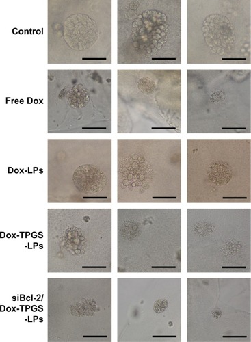 Figure 6 The images of H22 tumor spheroids treated with free Dox, Dox-LPs, Dox-TPGS-LPs, or siBcl-2/Dox-TPGS-LPs containing 5 µg/mL Dox for 72 hours; untreated tumor spheroids served as a control.Note: Scale bars represent 50 µm.Abbreviations: Dox, doxorubicin; LPs, liposomes; siBcl-2, Bcl-2 siRNA; TPGS, D-α-tocopherol polyethylene glycol 1000 succinate.