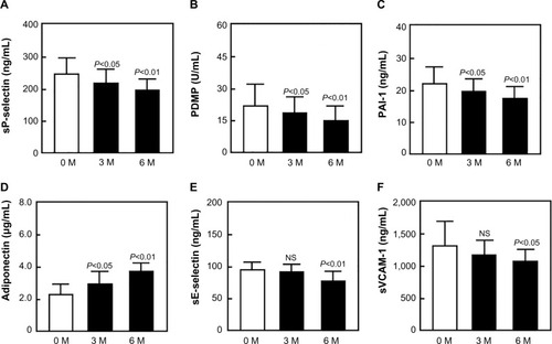 Figure 1 Plasma concentrations of sP-selectin (A), PDMP (B), PAI-1 (C), adiponectin (D), sE-selectin (E), and sVCAM-1 (F) before and after teneligliptin treatment of patients with diabetes.