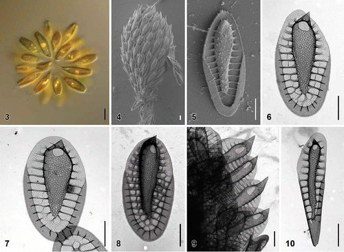 Figs. 3–10. Scale morphology of Synura borealis sp. nov. (Fig. 3: LM; Figs 4, 5: SEM; Figs 6–10: TEM). Scale bars represent 10 µm (Fig. 3) and 1 μm (Figs 4–10). Fig. 3. Colony consisting of elongated, lanceolate-shaped cells (strain S 90.G4). Fig. 4. Single cell surrounded by a layer of siliceous scales (S 90.G4). Fig. 5. Body scale (S 90.G4). Fig. 6. Body scale with transverse folds interconnecting the struts. Note the over-layered pore pattern at the scale keel (S 62.D7). Fig. 7. Body scale with obviously anteriorly widened keel (S 62.D7). Fig. 8. Apical scale (S 62.D7). Fig. 9. Apical scales with prominently protruding keel tips (S 58.C7). Fig. 10. Rear scale (S 62.D7).