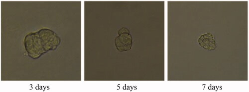 Figure 38. Celastrol and folic acid treatment group for 3D tumour spheroid. Scale bar = 100 μm.