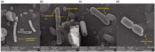 Figure 10. Scanning electron microscopy images of Ag NPs treated E. coil cell surface. (a) Nanoparticles on the cell surface, (b) membrane blebs, (c) membrane clumping and (d) bacterium damage.