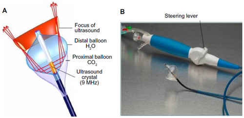 Figure 1 Schematic representation and photograph of the HIFU balloon.