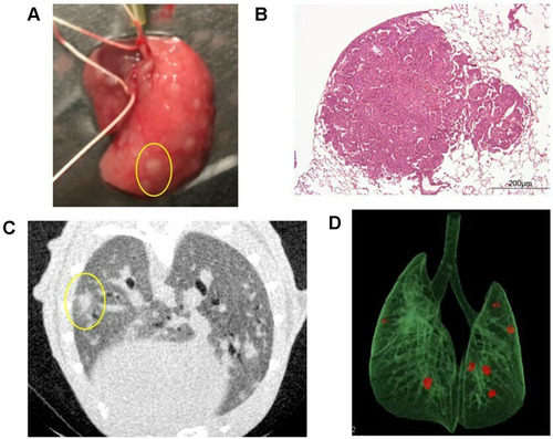 Figure 2 Pulmonary metastases. (A) Macroscopic findings of pulmonary metastasis in the right lobe of the lung. In this mouse, many nodules were identified (one is circled in yellow). (B) Hematoxylin-eosin staining of pulmonary metastasis in a mouse. (C) A representative two-dimensional image of a micro CT scan in a smoking mouse. In this mouse, one nodule was identified in the left lung (circled in yellow). (D) CT reconstruction of a pulmonary metastasis from a mouse model. Three-dimensional microstructural image data were reconstructed using Tri/3D-BON software. Red colored nodules indicate pulmonary metastasis.