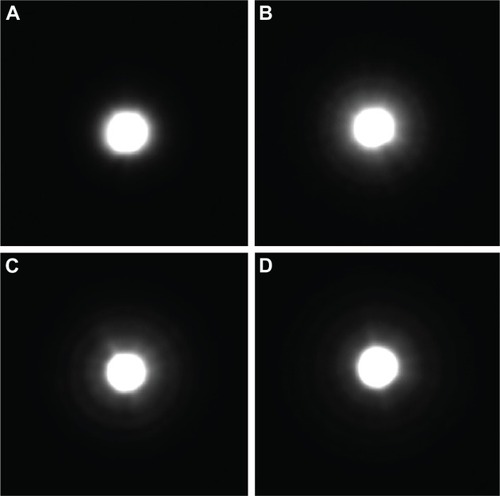 Figure 3 Optikos pinhole images: (A) IQ monofocal, (B) ReSTOR +2.5 D, (C) ReSTOR +3.0 D, and (D) ReSTOR +4.0 D.