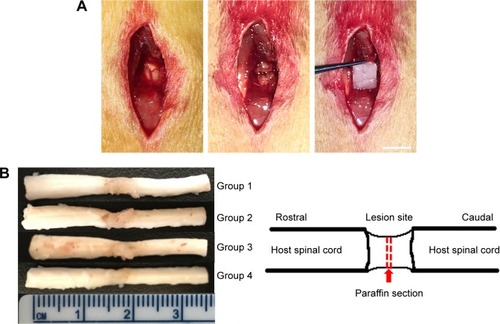 Figure 4 Axonal regeneration and remyelination of transplanted cells in injured spinal cord.Notes: (A) Spinal cord transection and transplantation. Scale bar =0.5 cm. (B) Gross morphology and cavity formation of spinal cord tissue. (C) H&E staining of Group 1 (a), Group 2 (b), Group 3 (c), and Group 4 (d). Arrows: infiltrated cells in spinal cord. Scale bar =100 µm.Abbreviation: H&E, hematoxylin–eosin.