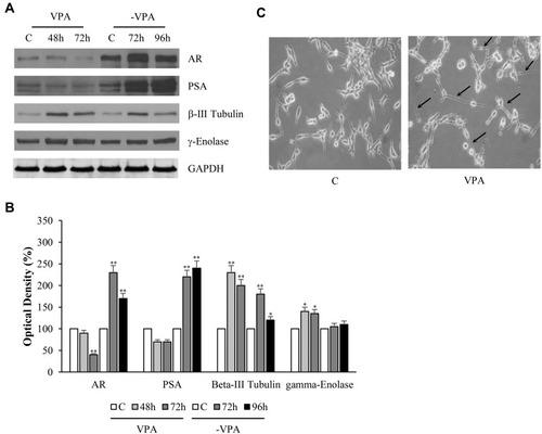 Figure 4 Changes of AR, PSA, β-III Tubulin and γ-Enolase protein expressions together with morphological modifications of human prostate cancer cells under valproic acid. LNCaP cells were treated with vehicle (C) or 1mM of VPA for 48 and 72 hrs. The latter condition was reproduced in triplicate, two of these plates were replaced by drug-free media (-VPA) and harvested for lysis respectively after 72 and 96 hrs. Replacement of media was also done for the corresponding control (A). Equal amounts of total cellular extracts were analyzed for androgen receptor (AR), prostatic-specific antigen (PSA), β-III Tubulin and γ-Enolase protein levels by immunoblotting analysis. GAPDH was used as loading control. Optical microscope imaging of untreated (left) and treated (right) LNCaP cells with VPA (1mM for 72 hrs) (C). Magnification 200×. The arrows in panel C indicate the cytoplasmic extensions similar to axonal figures. The W.B. is representative of three experiments, with similar results. The histograms represent the mean ± SD of three separate experiments in which band intensities were evaluated in terms of optical density arbitrary units and expressed as percentage versus vehicle-treated samples, respectively (B). *p<0.05, **p<0.01 vs C.