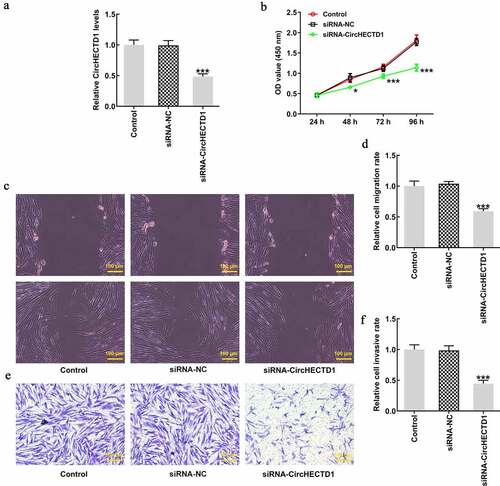 Figure 2. circHECTD1 knockdown inhibits the proliferation, migration and invasion of HSF. (a) Knockdown in HSF detected by RT-qPCR. ***P < 0.001 versus siRNA-NC; n = 3. (b) Proliferation expressed as OD value using CCK8 assay. *P < 0.05, ***P < 0.001 versus 24 h; n = 3. (c) Cell migration and (d) invasion detected by wound healing and Transwell assay, respectively. ***P < 0.001 versus siRNA-NC; n = 3.