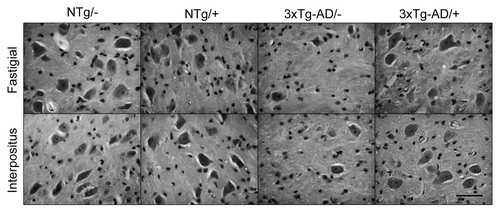 Figure 2. Illustrative photomicrographs of sagittal sections. At the level of the fastigial and interpositus nuclei the involvement of DCN neurons and its protection by scFv-h3D6 is shown. Bar is 50 µm.