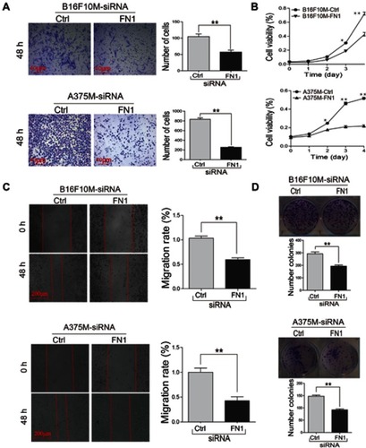 Figure 4 Knockdown of FN1 in metastatic melanoma cells significantly inhibited cell proliferation, migration and viability. (A) The cell migration was measured by transwell assay. (B) The growth curves were generated based on MTT assay. (C) The cell mobility was performed by wound-healing assay. (D) The cell proliferation was measured by clone formation assay. Representative pictures of the data were shown. The results showed that knockdown of FN1 in metastatic cells significantly inhibited cell proliferation, migration and viability. Data were presented as mean ± SD. *P<0.05; **P<0.01.Abbreviations: FN1, fibronectin 1.