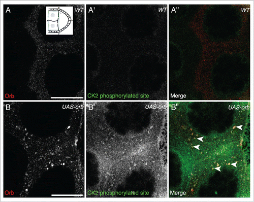 Figure 3. In UAS-Orb chamber, ectopically expressed Orb is phosphorylated by CK2. Double immunofluorescent staining of wild type (A-A″) and tubGal4-VP16; UAS-Orb (B-B″) egg chambers for Orb protein (red) and phosphorylated CK2 consensus sites (pS/pT-D-X-E, green). Inset: schematic illustrating the relative position of the oocyte and nurse cells for a stage 8 egg chamber, dashed blue box highlights area focused on in both (A-A″) and (B-B″). (A-A″) In the nurse cells of wild-type egg chambers, Orb protein is at a low level and CK2 activity is below the level of detection (n = 12/12). (B) tubGal4-VP16; UAS-Orb egg chambers, have ectopically expressed Orb in foci of varying sizes throughout the nurse cells (n=12/12). (B′) Phosphorylated CK2 consensus sites are visible in tubGal4-VP16; UAS-Orb egg chambers (n = 12/12). (B″) Merge of 2 stains showing that ectopically expressed Orb protein in the nurse cells is phosphorylated by CK2 (white arrowheads). Single slices, scale bar 20 μm.