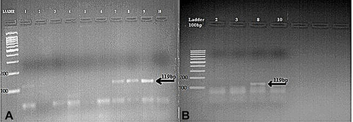 Figure 2 Agarose gel electrophoretic analysis of DENG samples amplified by One-Step Multiplex RT-PCR. (A) Human samples; amplified products of clinical samples, positive samples showing 119 bp (DENV-2). (B) Amplified products of Adult female Aedes aegypti, positive samples showing 119 bp (DENV-2). DNA ladder 100 bp.