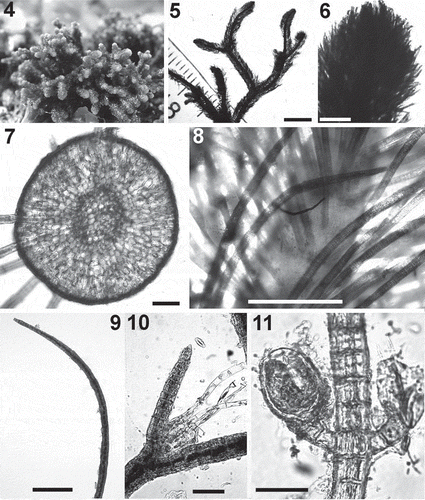 Figs 4–11. Cladostephus spongiosus. Fig. 4. Habit of a specimen in the field. Fig. 5. Habit of erect axes. Fig. 6. Detail of apex of an erect axis. Fig. 7. Cross section of an erect axis. Fig. 8. Detail of an erect axis with whorled branches. Fig. 9. An unbranched whorled branch. Fig. 10. A tuft of hairs formed in the axil of a branchlet. Fig. 11. Detail of unilocular sporangia. Scale bars: Fig. 5 = 4.3 mm; Fig. 6 = 500 μm; Fig. 7 = 100 μm; Figs 8–9 = 300 μm; Fig. 10 = 50 μm; Fig. 11 = 30 μm