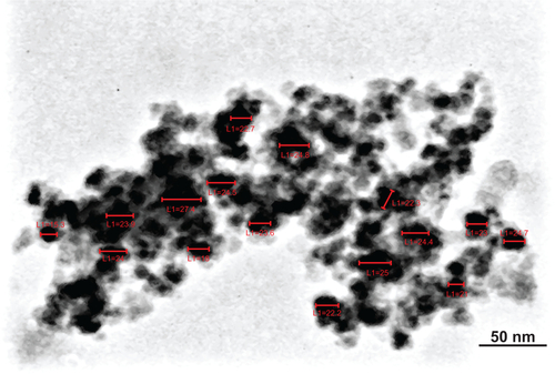 Figure S3 Scaling of transmission electron microscopy image of MSc1 for nanoparticle size–distribution histogram.Abbreviation: L, length.