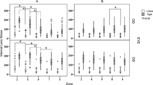 Figure 4 Box plots of the internal lens stress distribution in the different zones. Statistically significant differences between the different zones after the post hoc tests are marked with lines and asterisks. (A) Vertically arranged zones. (B) Horizontally arranged zones. * P<0.05.