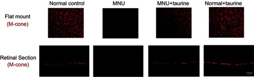 Figure 6 In the retinal sections, S-opsin staining in the N-methyl-N-nitrosourea (MNU) group was lost. On the other hand, the S-opsin staining was evident in the ONL of the MNU+taurine group. In the retinal flat mounts, the S-cone opsin positive cell counts in the MNU+taurine group were significantly larger than those in the MNU group. In the MNU+taurine group, the S-cone opsin positive cells were distributed throughout the retinal flat mount. Most of the S-opsin positive cells were located in the IN quadrants and the fewest cells in the ST quadrant, suggesting that S-cone photoreceptors from the IN quadrant benefited most from the taurine treatment.