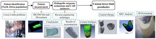 Figure 1. Process to reconstruction of the lower limb amputated and design a custom prosthetics implants.