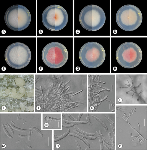 Figure 3. Fusarium kazakhstanicum. A–H. Colony morphology after 8 d growth on PDA using a 12/12 h photoperiod. Colony surface is shown on left half of each plate and colony undersurface on right half. A. KG159. B. KG160. C. KG210. D. KG211. E. KG228. F. KG231. G. KG232. H. KG437. I–P. KG160. I–J. Sporodochia on carnation leaf. K. Aerial conidia formed on monophialides. L, P. Microconidia in false heads on monophialides. M. 0–3-septate aerial conidia. N. Chlamydospores. O. Fusiform, mostly 3-septate sporodochial conidia. Bars: I = 1 mm; J–P = 20 μm.