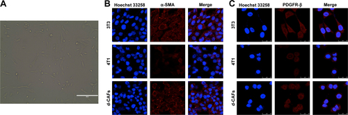 Figure S1 Characterization and certification of d-CAFs derived from 4T1 tumor bearing mice.Notes: (A) Morphology of the fifth-passage d-CAFs observed using a microscope. Images show the spindle shape with irregular branches (scale bar: 200 µm). (B, C) Two cell markers of α-SMA and PDGFR-β were employed to certify cell purity for d-CAFs (scale bar: 25 µm).Abbreviations: d-CAFs, detached cancer-associated fibroblasts; α-SMA, α-smooth muscle actin; PDGFR-β, platelet-derived growth factor receptor-β.