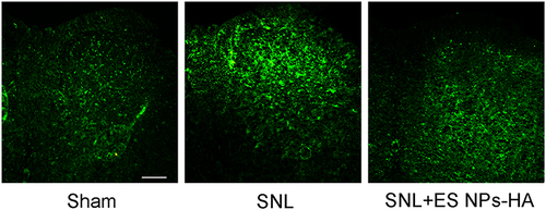 Figure 7 Effect of ES NPs-HA on spinal astrocytes in mice. On day 5 postoperative, L4 spinal sections were taken and incubated with anti-GFAP antibodies. Sham (A); SNL (B); SNL+ES NPs-HA (C). Scale bar: 100 µm.