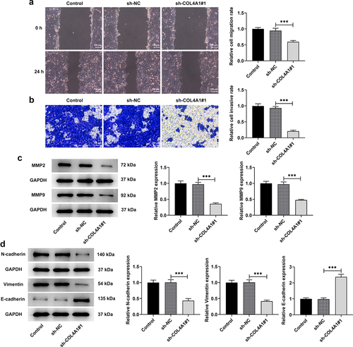 Figure 3. COL4A1 shortage inhibited the invasion, migration and EMT of MKN-45 cells. Cell migration and invasion were respectively evaluated by (a) wound healing and (b) transwell assays. (c) Western blot analyzed the protein levels of metastasis-related factors. (d) The expressions of EMT-related proteins were detected using Western blot.