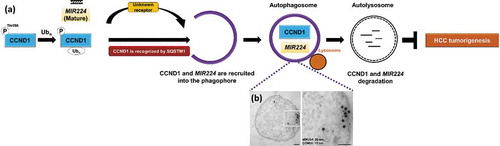 Figure 1. A schematic hypothetical diagram of degradative autophagy, selective regulation of MIR224 and CCND1 and evidence of MIR224 and CCND1 coexistence in the autophagosome. (a) CCND1 is selectively recruited to the phagophore through the specific receptor SQSTM1. MIR224 is preferentially recruited to the phagophore by unknown factors. Both of the oncogenic factors are present in autophagosomes after selective recruitment; subsequent autophagosome fusion with the lysosome is followed by degradation. (b) Human liver cancer Hep 3B cells were treated with the autophagy inducer amiodarone. Coexistence of immunogold-labeled CCND1 (12-nm bead) and MIR224 (20-nm bead) after miRNA in situ hybridization in the purified autophagosomes was investigated using TEM. Scale bar: 100 nm.