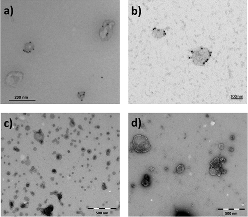 Figure 1. Representative transmission electron microscopy (TEM) images of negatively stained EVs used for NTA measurement variation assessment. The images show (a) exosomes derived from PC-3 cells labelled for CD63, (b) exosomes from Jurkat cells labelled for CD81, (c) OMVs derived from Neisseria meningitidis bacteria and (d) microvesicles from human monocytes. Scale bar sizes are 200, 100, 500 and 500 nm for (a), (b), (c) and (d), respectively. All images indicate the presence of intact vesicles of various sizes.