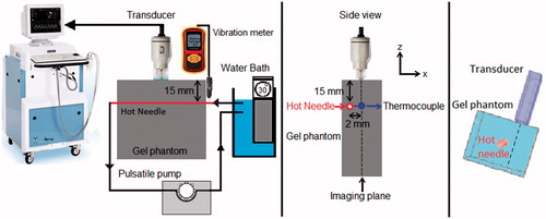 Figure 2. Schematic of the experimental setup. The side view of the setup shows that the hot needle is placed laterally 2 mm away from the imaging plane of the transducer and the tip of the thermocouple is placed within the imaging plane (2 mm away from the heating needle). The temperature at the thermocouple location changed from 26 °C to 46 °C.