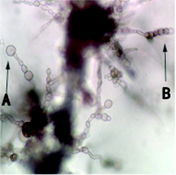 Figure 4. (A) Conidiophores and (B) conidia chains treated with bacteria-free filtrate.