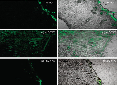 Figure 2. Topical delivery of CPP-coated NLC in rat skin: Lipophilic fluorescent dye (DID) was encapsulated in various NLC preparations and the particles were incubated with rat skin in vitro. The vertical skin sections with a thickness of 30 μm were made with cryotome and were observed under confocal microscope for skin associated fluorescence. Left panel, DID fluorescence; right panel, overlay of bright field and fluorescence. Results indicate that surface modification of nanoparticles with TAT enhances the skin permeation, whereas addition of non-transduction peptide (YKA) inhibits the entry of nanoparticles into the skin.