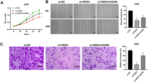 Figure 7 VSIG4 could regulate JAK2/STAT3 pathway to promote GBM viability, migration and invasion. (A) Detection of cell viability by CCK-8 in si-NC, si-VSIG4, and si-VSIG4+AG490 groups; (B) Detection of cell migration in si-NC, si-VSIG4, and si-VSIG4+AG490 groups by scratch assay; (C) Detection of cell invasion in si-NC, si-VSIG4, and si-VSIG4+AG490 groups by transwall assay. The scale bar was 100μm. CCK-8 assay was repeated 4 times, and scratch test and transwall assay were repeated 3 times, respectively.