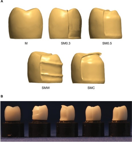 Figure 2 Different crown designs shown: (A) in the CAD software and (B) after milling and sintering.