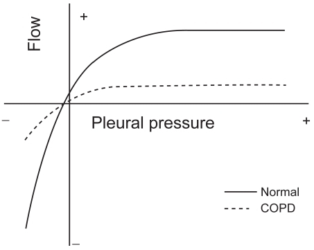 Figure 3 Iso-volume pressure-flow relationship. Schematic representation of the pressure-flow relationship in a healthy (normal) subject and a patient with COPD, showing the effect of the increased expiratory resistance upon the maximum expiratory flow and in both cases the independence of the maximum flow from the pleural pressure. Copyright © 1986. Modified with permission from CitationPride NB, Macklem PT. 1986. Lung mechanics in disease. In: Fishman AP (ed). Handbook of physiology, Section 3, Volume III, Part 2: The respiratory system. Bethesda MD: American Physiological Society, pp 659–92.