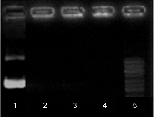 Figure 1 Agarose gel electrophoresis of the pDNA/D-SPM complex at different ratios.Notes: Line 1, free pDNA plasmid; lines 2–4, pDNA/D-SPM complexes at ratios 12, 16, and 18 μg, respectively; line 5, GeneRuler GeneRuler™ DNA ladder 1 kb (Fermentas Canada, Burlington, ON, Canada).Abbreviations: pDNA, plasmid DNA; D-SPM, dextran-spermine.