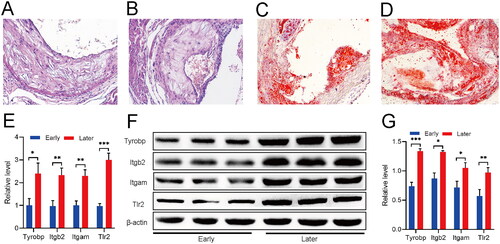 Figure 8. Molecular biology experiment in mouse atherosclerosis model. (A) HE staining of atherosclerotic tissues at early stages. (B) HE staining of atherosclerotic tissues at later stages. (C) Oil red O staining of atherosclerotic tissues at early stages. (D) Oil red O staining of atherosclerotic tissues at later stages. (E) Histogram of qPCR results of mRNA level of Tyrobp, Itgb2, Itgam and Tlr2 in atherosclerotic tissues at different stages. (F) WB detection results of the protein level of Tyrobp, Itgb2, Itgam and Tlr2 in atherosclerotic tissues at different stages. (G) Histogram of WB results of Tyrobp, Itgb2, Itgam and Tlr2 in atherosclerotic tissues at different stages. Data were expressed as mean ± SEM, *p < .05, **p < .01, ***p < .001, n = 6 compared with early atherosclerosis group.