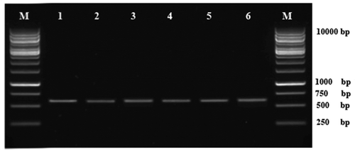 Fig. 2. Agarose gel showing amplification of the ITS-5.8S rDNA fragments from isolates of Pithomyces chartarum. Lanes 1–6: isolates of P. chartarum. M: 1kb DNA Ladder (Fermentas, Axon Scientific, Malaysia).