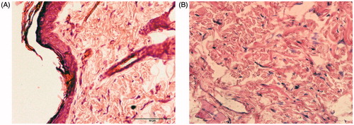 Figure 10. Histological evaluation of blank group (A) and adjacent tissues injected with the formulation after 10 d (B). Original magnification: 400×.