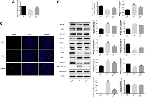 Figure 3 (A-B) The autophagy and apoptosis-related proteins were detected by WB or RT-qPCR. Data were shown as mean±SD. (C) YNJ reduced renal cells apoptosis detected by TUNNEL staining. ***p<0.001 comparing to CON group. #p<0.05, ##p<0.01 or ###p<0.001 comparing to GK group.