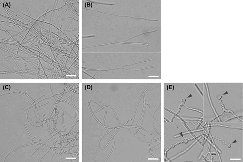 Fig. 4. Microscopic observation of liquid cultured hyphae of the ΔfaaA (A, B) and the ΔfaaA_tktOE (C–E) strains.