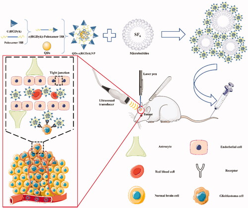 Figure 1. Schematic diagram illustrating accurate tracing of glioma in the brain using the UTMD technique combined with QD-loaded nanoparticles to guide glioma surgery.