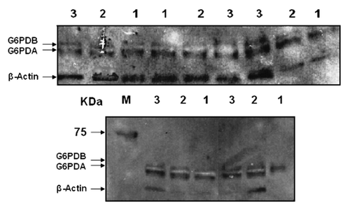 Figure 1. Representative results of immunoblot analysis of protein extracts of tail-biopsies of animals fed on (1) negative; (2) transit to positive; and (3) positive energy balance. Twenty-five micrograms of protein were loaded on a 8–16% gradient polyacrylamide gel and dry-blotted on PVDF membrane and further incubated with primary G6PDH-specific and HRP-secondary antibody (see Materials and Methods). Samples numbers correspond to the following samples: (1) first WPW; (2) second WPW; and (3) fourth WPW. Protein expression of oG6PDA and oG6PDB was altered through the course of time and the levels of β-actin protein are shown below in the immunoblot. oG6PDH protein isoform expression was normalized to β-actin protein.